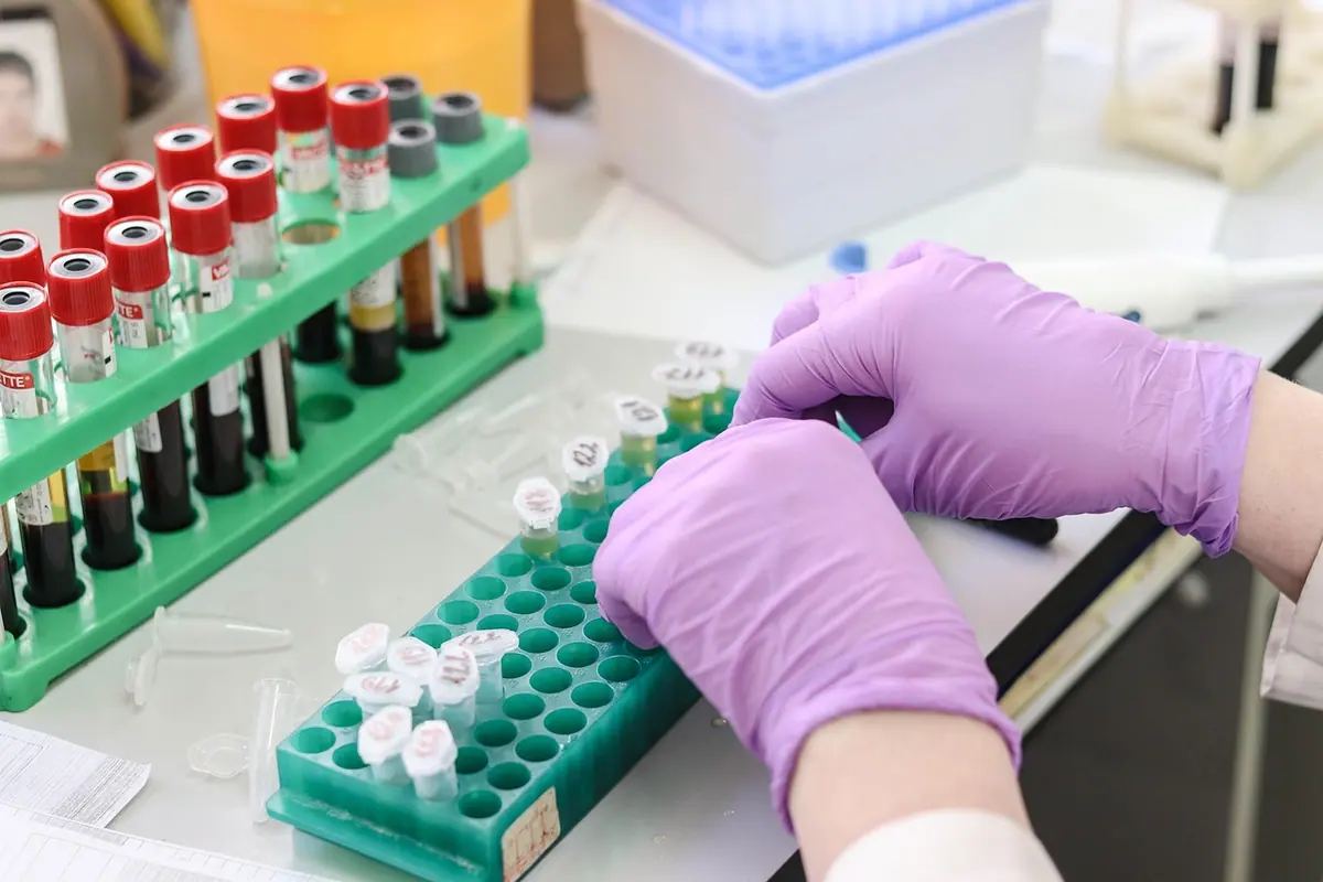 Mâini cu mănuși mov pregătesc eprubete cu sânge pe un stativ, într-un laborator